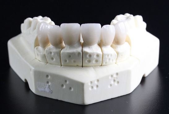 زراعة الاسنان