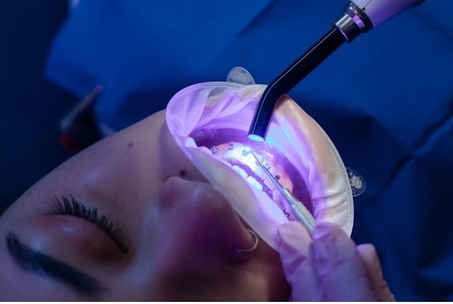 أسباب نزيف اللثة؟ طرق العلاج والوقاية